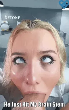 brain damage
